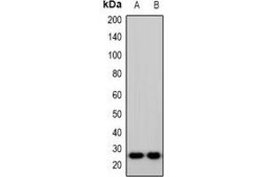 Western blot analysis of IMP3 expression in Hela (A), HepG2 (B) whole cell lysates.