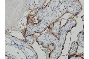 Immunoperoxidase of monoclonal antibody to ALPPL2 on formalin-fixed paraffin-embedded human placenta.