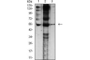 Western blot analysis using CHRNE mouse mAb against Jurkat (1), C6 (2), and SK-N-SH (2) cell lysate.