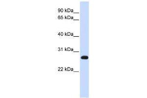 SNAP23 antibody used at 1 ug/ml to detect target protein. (SNAP23 anticorps  (N-Term))