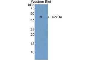 WB of Protein Standard: different control antibodies against Highly purified E.