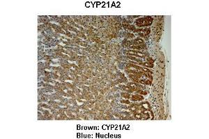 Sample Type : Monkey adrenal gland  Primary Antibody Dilution :  1:25  Secondary Antibody: Anti-rabbit-HRP  Secondary Antibody Dilution:  1:1000  Color/Signal Descriptions: Brown: CYP21A2 Blue: Nucleus  Gene Name: CYP21A2  Submitted by: Jonathan Bertin, Endoceutics Inc. (CYP21A2 anticorps  (C-Term))