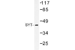 Image no. 1 for anti-Synaptotagmin I (SYT1) antibody (ABIN272235) (SYT1 anticorps)