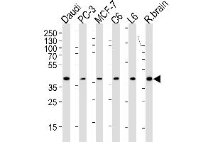 CREB3L4 Antibody (M01) (ABIN1882047 and ABIN2838479) western blot analysis in Daudi,PC-3,MCF-7,rat C6 and L6 cell line ,rat brain tissue lysates (35 μg/lane). (CREB3L4 anticorps  (AA 1-300))