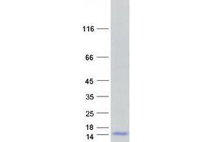 Validation with Western Blot
