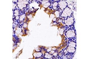 Immunohistochemistry of paraffin embedded mouse colon using Neil1 (ABIN7073820) at dilution of 1: 1200 (400x lens)