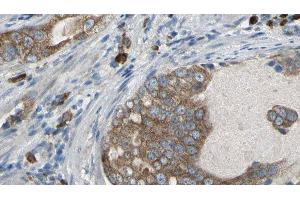 ABIN6277086 at 1/100 staining Human prostate tissue by IHC-P. (PDE1B anticorps  (C-Term))