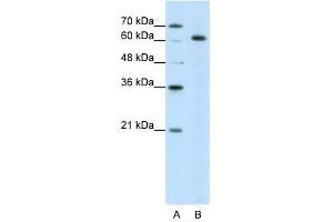 SNRP70 antibody used at 5 ug/ml to detect target protein. (SNRNP70 anticorps)