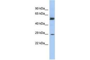 Image no. 1 for anti-Glutathione S-Transferase mu 3 (Brain) (GSTM3) (AA 143-192) antibody (ABIN6743751) (GSTM3 anticorps  (AA 143-192))