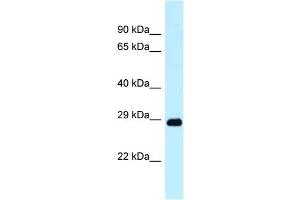 WB Suggested Anti-Dram1 Antibody Titration: 1. (DRAM anticorps  (N-Term))
