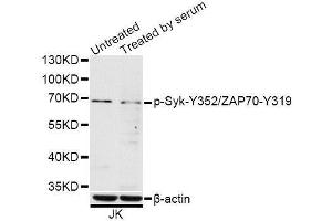 Western blot analysis of extracts of Jurkat cells, using Phospho-Syk-Y352/ZAP70-Y319 antibody (ABIN5996169) at 1/1000 dilution. (SYK anticorps  (pTyr319, pTyr352))