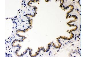 IHC testing of FFPE rat lung with COMT antibody. (COMT anticorps  (AA 52-271))