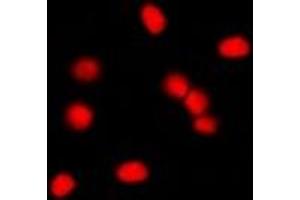 Immunofluorescent analysis of MDM2 staining in NIH3T3 cells. (MDM2 anticorps)