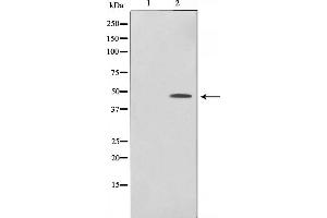 Western blot analysis of c-Jun phosphorylation expression in UV treated HeLa whole cell lysates,The lane on the left is treated with the antigen-specific peptide.