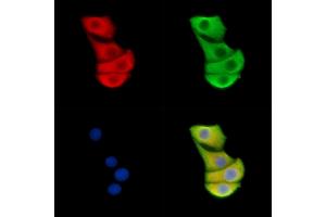 ABIN6262399 and ABIN6278869 staining Hela cells by IF/ICC. (HSPA9 anticorps  (C-Term))