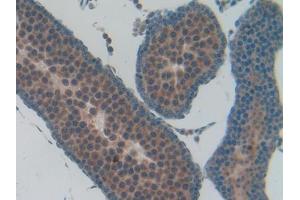 IHC-P analysis of Rat Testis Tissue, with DAB staining. (Osteocalcin anticorps  (AA 11-98))