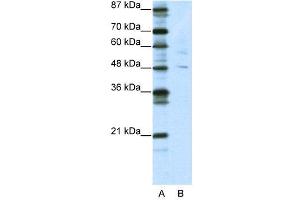 WB Suggested Anti-PLAGL1  Antibody Titration: 5.
