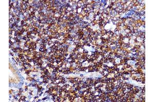 Immunohistochemistry of paraffin-embedded human appendix using PI3 Kinase p85 alpha Rabbit mAb (ABIN7269319) at dilution of 1:100 (40x lens).