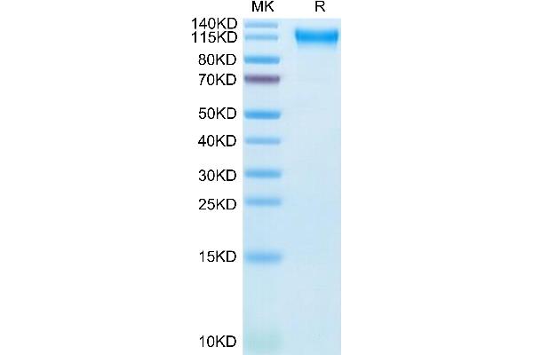 SEMA4D/CD100 Protein (AA 24-734) (His tag)