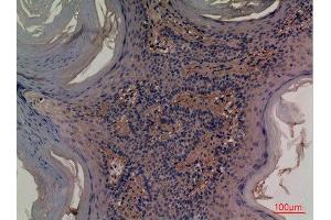 Immunohistochemistry (IHC) analysis of paraffin-embedded Human Skin, antibody was diluted at 1:100. (CD73 anticorps  (Internal Region))