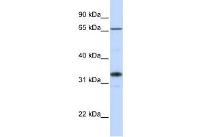 WB Suggested Anti-B3GALT1 Antibody Titration:  0. (B3GALT1 anticorps  (C-Term))