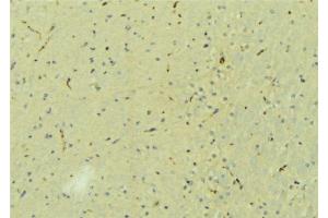 ABIN6273214 at 1/100 staining Mouse brain tissue by IHC-P.