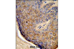 Formalin-fixed and paraffin-embedded human skin tissue reacted with TCHP Antibody , which was peroxidase-conjugated to the secondary antibody, followed by DAB staining.