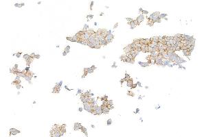 Immunocytochemistry (ICC) image for anti-Receptor tyrosine-protein kinase erbB-2 (ErbB2/Her2) (AA 1205-1255) antibody (ABIN7455181) (Recombinant ErbB2/Her2 anticorps  (AA 1205-1255))