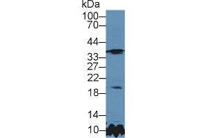 Western Blot; Sample: Rat Cerebrum lysate; Primary Ab: 5µg/ml Rabbit Anti-Rat TIMP3 Antibody Second Ab: 0.