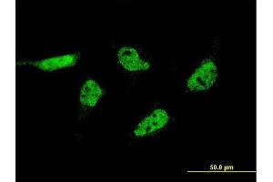 Immunofluorescence of monoclonal antibody to C17orf88 on HeLa cell. (FAM215A anticorps  (AA 28-114))