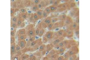 IHC-P analysis of Human Tissue, with DAB staining. (SULT1A1 anticorps  (AA 2-295))