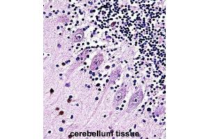 Immunohistochemistry (IHC) image for anti-Transient Receptor Potential Cation Channel, Subfamily C, Member 5 (TRPC5) antibody (ABIN2997528)