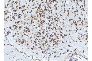 ABIN6272976 at 1/100 staining Rat brain tissue by IHC-P. (PSAT1 anticorps  (Internal Region))