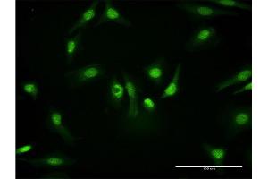Immunofluorescence of monoclonal antibody to PKM2 on HeLa cell. (PKM2 anticorps  (AA 436-531))