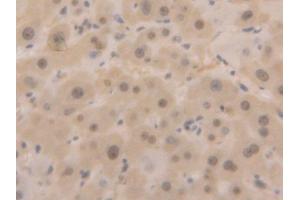 Used in DAB staining on fromalin fixed paraffin- embedded liver tissue (GAPDH anticorps  (AA 2-148))