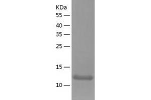 Western Blotting (WB) image for Pleckstrin Homology Domain Interacting Protein (PHIP) (AA 1146-1287) protein (His-IF2DI Tag) (ABIN7124492)
