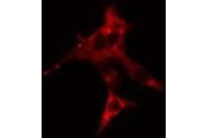 ABIN6268950 staining  HepG2 cells by IF/ICC.