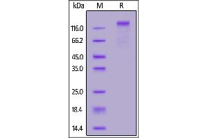 Biotinylated Human CD45, His,Avitag on  under reducing (R) condition.