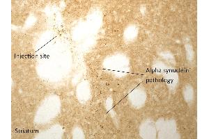 Immunohistochemistry (IHC) image for Synuclein, alpha (SNCA) (full length) (Active) protein (ABIN5065829)