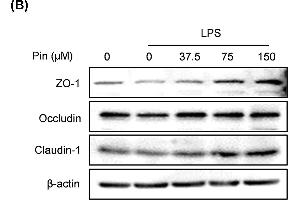 Pinocembrin increased the expression of tight junction proteins in vitro(A) Caco-2 cells were treated with different concentration of pinocembrin (0-150 μM) for 24 h, and then the mRNA expression of Occludin, Claudin-1 and JAM-A in Caco-2 cells were determined by qRT-PCR. (TJP1 anticorps  (AA 1600-1700))