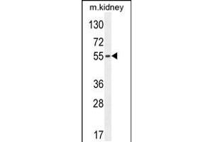 Western blot analysis in mouse kidney tissue lysates (35ug/lane). (FBXO39 anticorps  (C-Term))