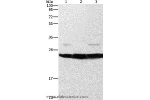 Western blot analysis of Mouse liver and brain tissue, A549 cell, using SIGMAR1 Polyclonal Antibody at dilution of 1:310 (SIGMAR1 anticorps)