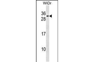 Western blot analysis in WiDr cell line lysates (35ug/lane). (RFXANK anticorps  (AA 94-123))