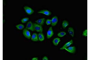 Immunofluorescent analysis of A549 cells using ABIN7145918 at dilution of 1:100 and Alexa Fluor 488-congugated AffiniPure Goat Anti-Rabbit IgG(H+L)