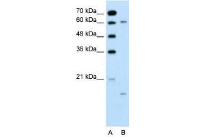 CYP4A22 antibody used at 0. (CYP4A22 anticorps  (N-Term))
