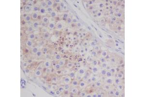 Immunohistochemical analysis of paraffin-embedded human testis, using MAP1LC3A Antibody.