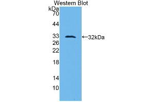 Western blot analysis of the recombinant protein. (PLAU anticorps  (AA 180-433))