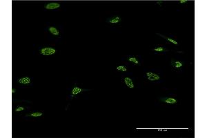 Immunofluorescence of monoclonal antibody to LHX4 on HeLa cell. (LHX4 anticorps  (AA 291-390))