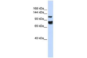 WB Suggested Anti-HDAC4 Antibody Titration:  0. (HDAC4 anticorps  (Middle Region))