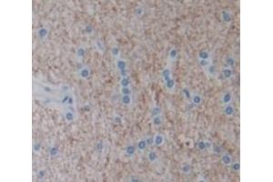 Used in DAB staining on fromalin fixed paraffin- embedded Kidney tissue